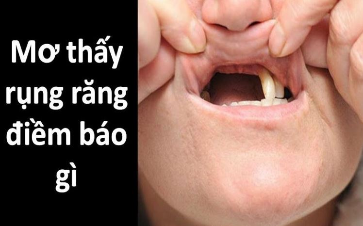 giải mã giâc mơ thấy rụng răng